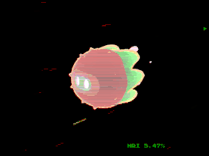 motoko_pals: 6399