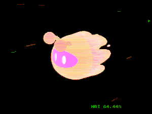 motoko_pals: 2991