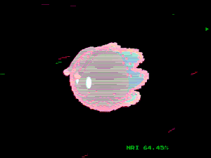 motoko_pals: 1340