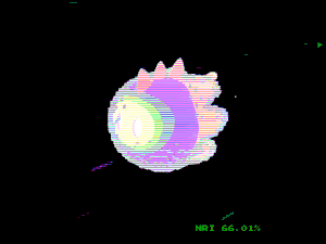 motoko_pals: 9990